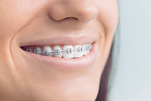 Full Mouth Reconstruction in Rockwood, TN